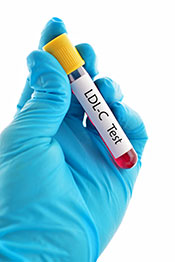 Imagen de un médico haciéndose una prueba de colesterol LDL.